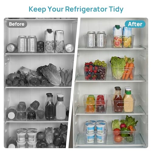 8pcs Clear Storage Bins with Handles (Transparent)
