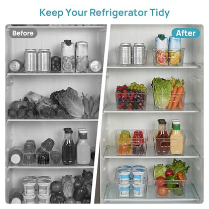 8pcs Clear Storage Bins with Handles (Transparent)