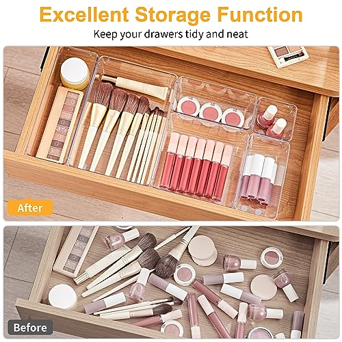 SMARTAKE 13-Piece Drawer Organizers with Non-Slip Silicone Pads, 5-Size | Clear Desk Bathroom Drawer Organizer Trays Storage Tray for Makeup, Jewelry, Utensils in Bedroom Dresser, Office and Kitchen